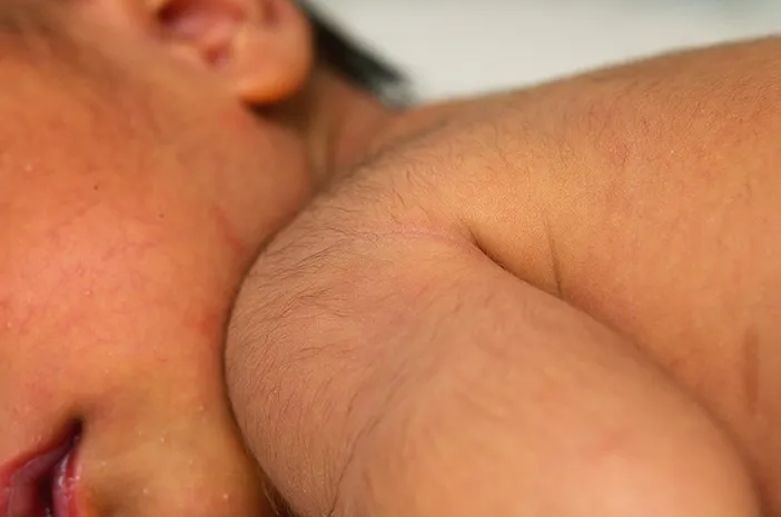 Kapan Lanugo pada Bayi Hilang? Ketahui Waktu Normalnya