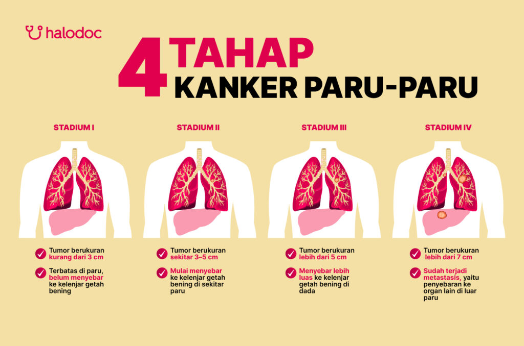 Kanker Paru-Paru - gejala kanker paru