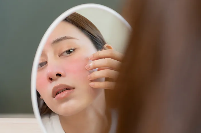 Makeup Bikin Perempuan Lebih Rentan Mengalami Dermatitis