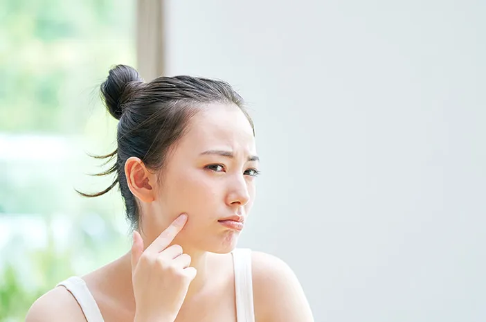 Flek Hitam Hilang? Ini Cara Cepat Mengelupasnya