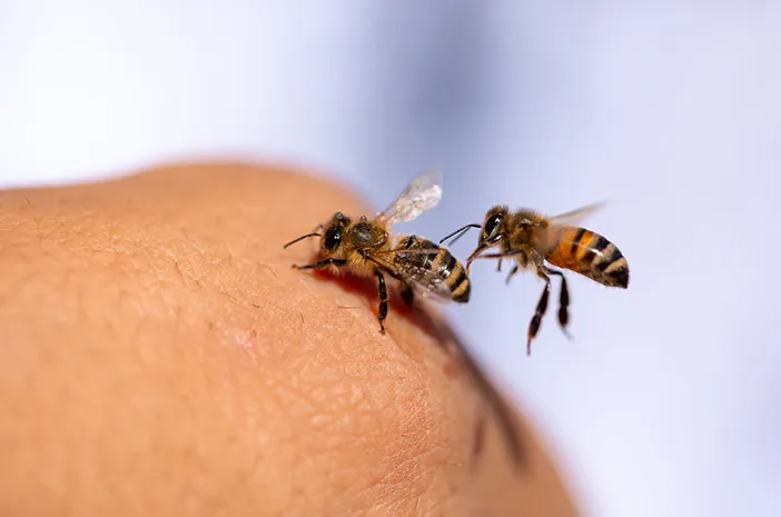 Ini Cara Mengobati Sengatan Lebah agar Cepat Reda