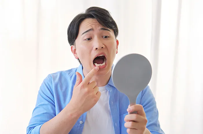 Ini 5 Penyebab Karang Gigi Hitam dan Cara Mengatasinya