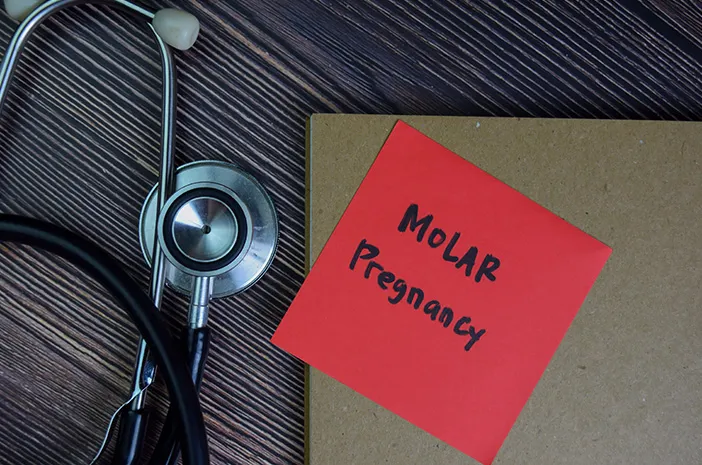 Mola Hidatidosa: Penyebab, Gejala dan Penanganannya