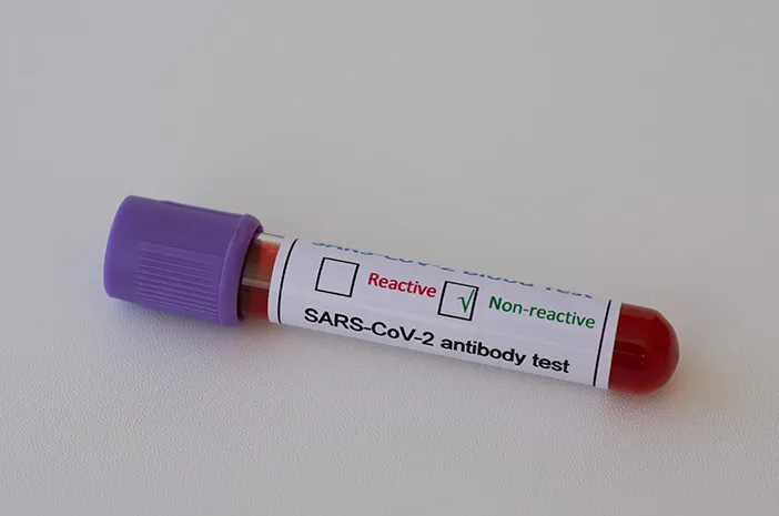 Non Reaktif Artinya Apa dalam Hasil Tes Kesehatan? Ini Penjelasannya