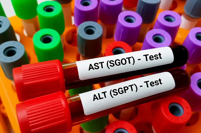 Ini Beda SGOT dan SGPT yang Perlu Diketahui