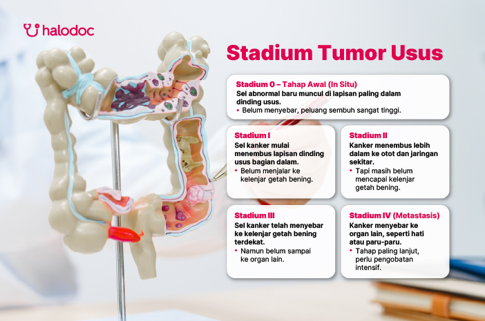 Stadium Tumor Usus