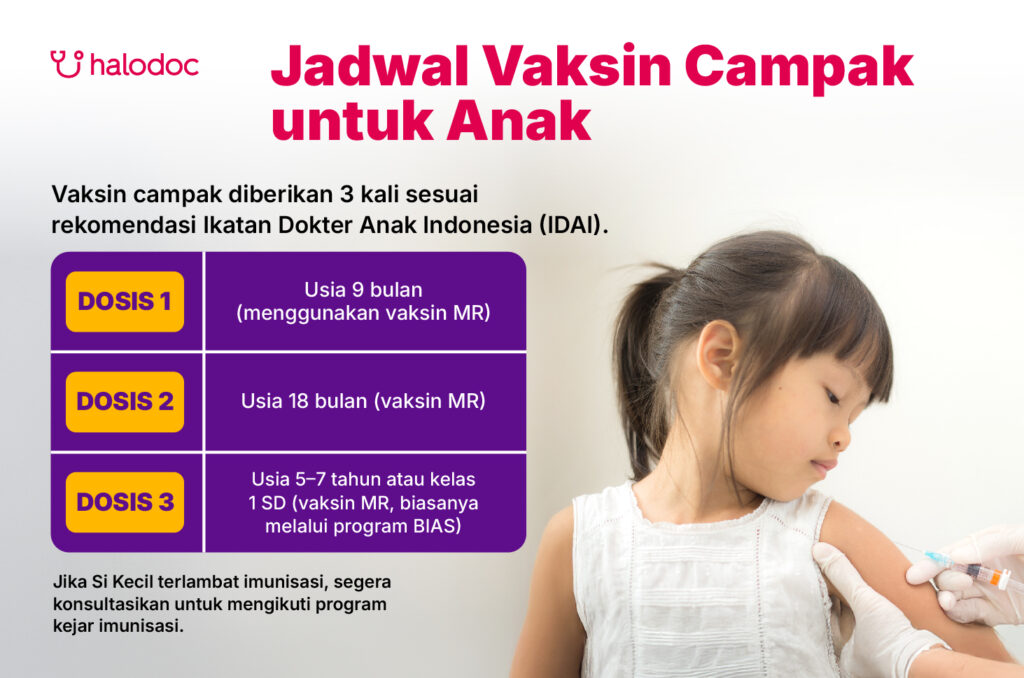 Jadwal Vaksin Campak untuk Anak