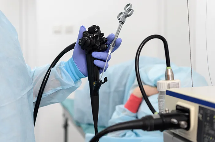 Ini 10 Jenis Endoskopi Berdasarkan Organ Tubuh yang Diamati