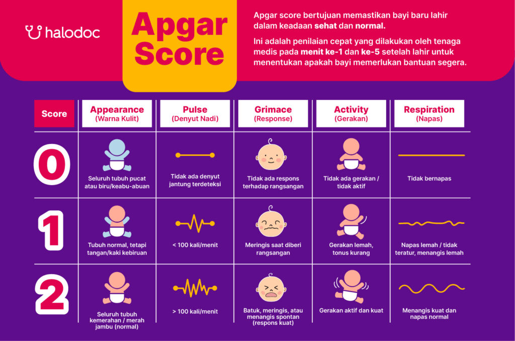 Apgar Score: Metode untuk Menilai Kondisi Bayi Baru Lahir