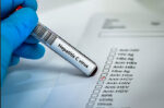 penyakit hepatitis A