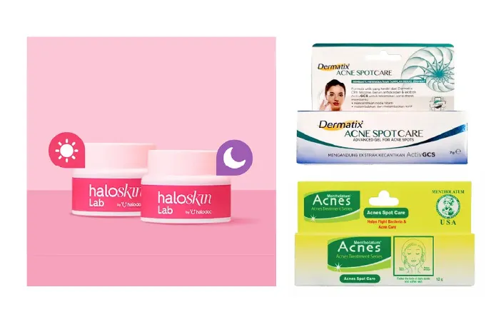 Rekomendasi Salep Penghilang Bekas Jerawat yang Ampuh