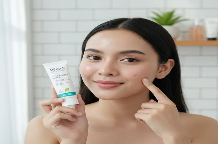 Verile Acne Blemish Cream: Noda Jerawat Minggat!