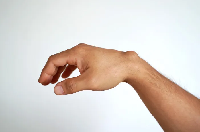 Dianggap Sepele, Lipoma Bisa Berakibat Fatal? Kenali Lebih Dalam