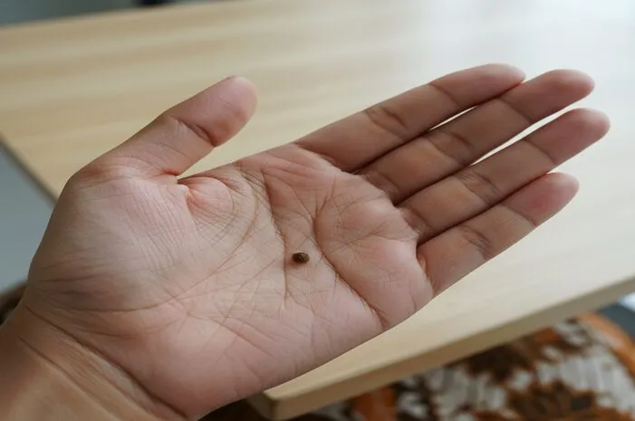 Arti Tahi Lalat di Telapak Tangan Kiri: Mitos dan Makna