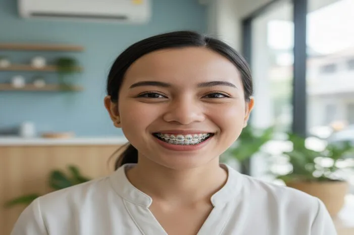 Lingual Braces: Kelebihan, Kekurangan, dan Harga Terbaru