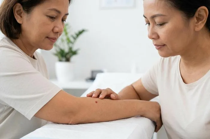 Tahi Lalat Merah: Penyebab, Ciri & Cara Hilangkan