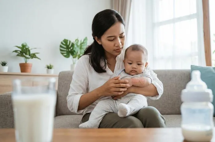 Kenali Ciri Ruam Alergi Susu Sapi dan Cara Atasinya