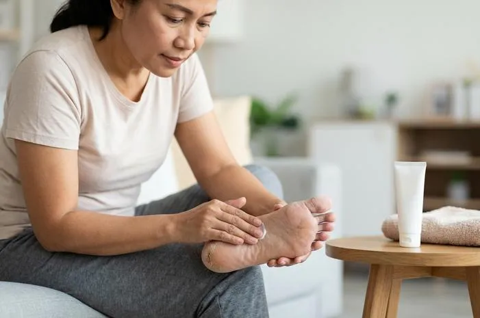 Kenali Rorombeheun Artinya Kaki Pecah Pecah dan Solusinya