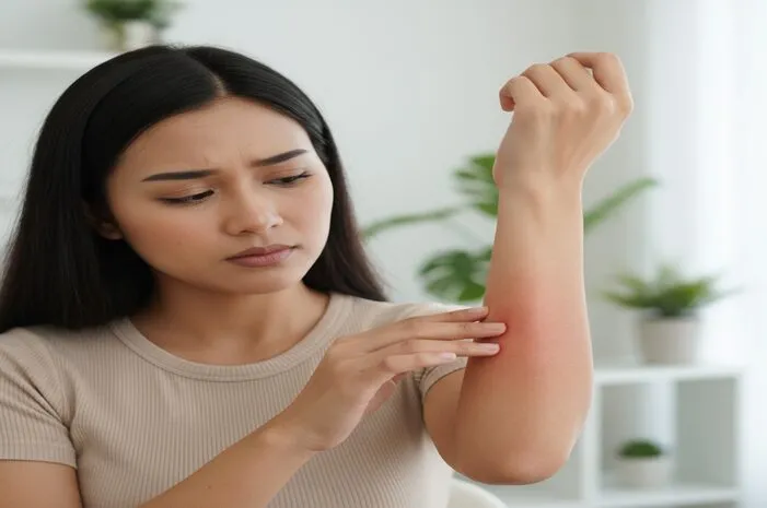 Kulit Terbakar? Kenali Penyebab dan Cara Atasinya!