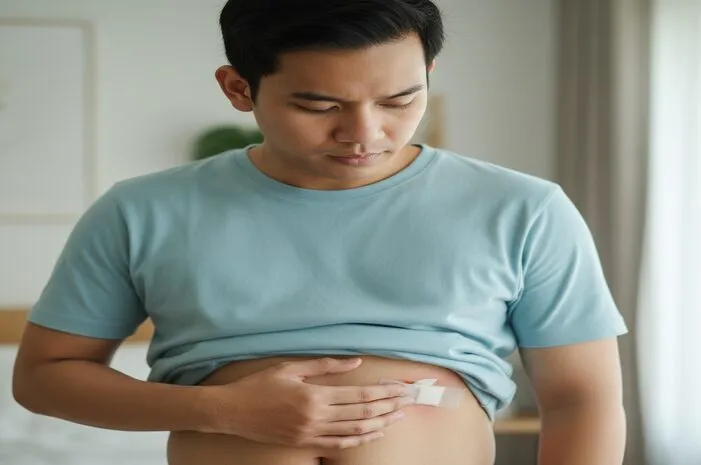 Gambar Infeksi Jahitan Usus Buntu: Ciri dan Cara Atasi