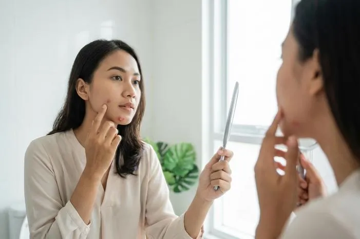 Perbedaan Bisul dan Jerawat: Kenali dan Atasi!