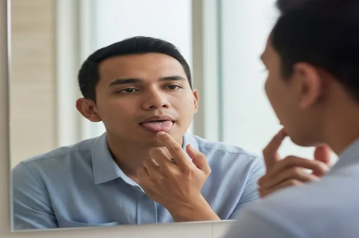 Sifilis Lidah: Gejala, Penularan dan Cara Mengobati!