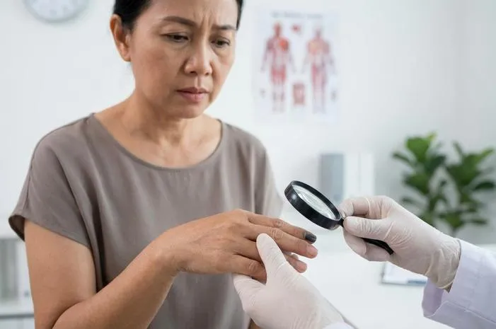 Kuku Hitam Kenapa? Ini Penyebab dan Cara Mengatasinya