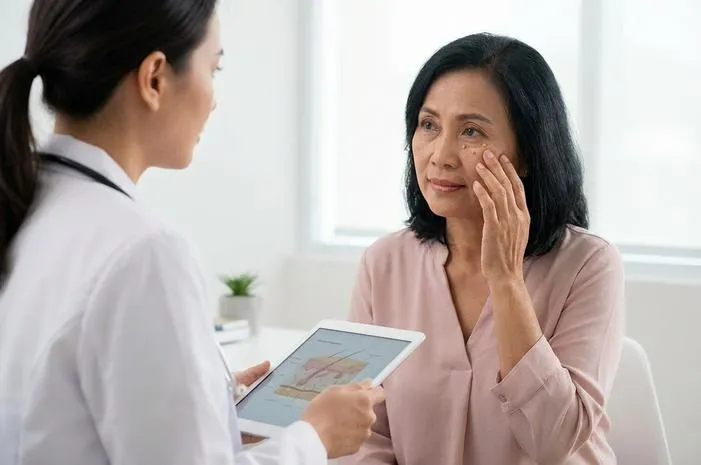 Syringoma: Kenali Penyebab, Gejala, Cara Hilangkannya