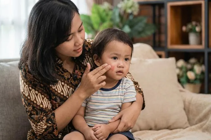 Suleten: Kenali Gejala dan Cara Mengatasi Impetigo