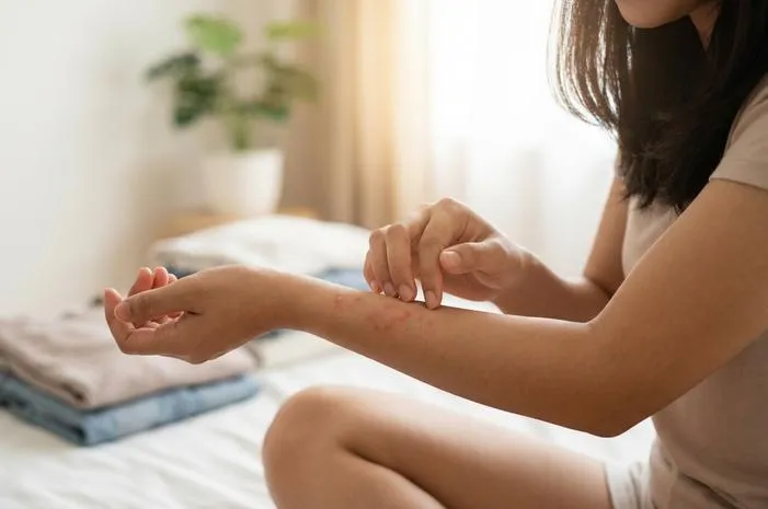 ICD 10 Folikulitis: Kode, Jenis, dan Penjelasan Lengkap