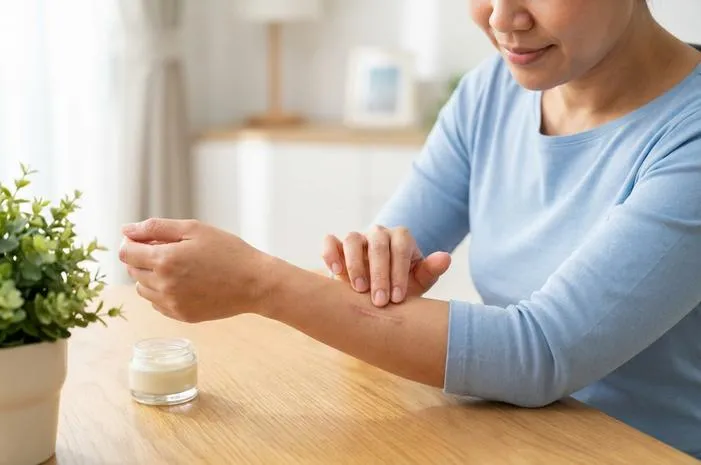 Bekas Jahitan: Cara Hilangkan dan Tips Perawatan