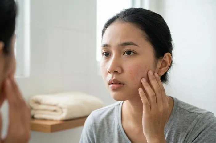 Efek Samping Shinzui Facial Wash: Awas Iritasi!