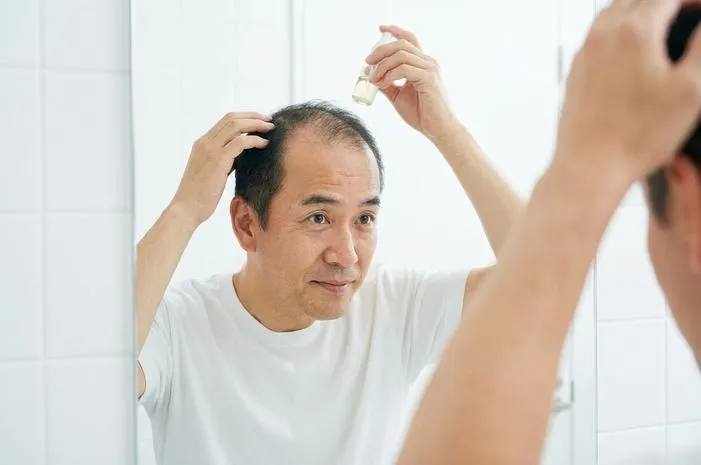 Cara Menumbuhkan Rambut Botak: Tips Ampuh dan Alami!