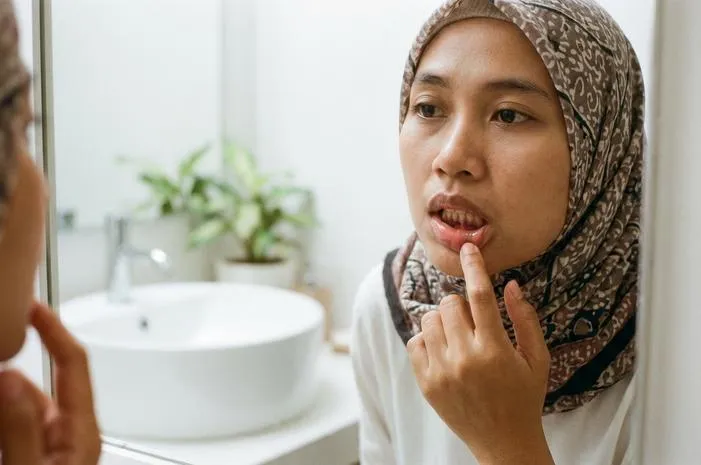 Gusi Hitam: Penyebab, Cara Mengatasi dan Pencegahan