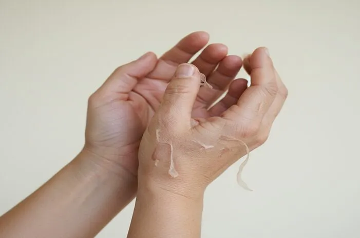 Telapak Tangan Mengelupas: Penyebab dan Cara Mengatasi