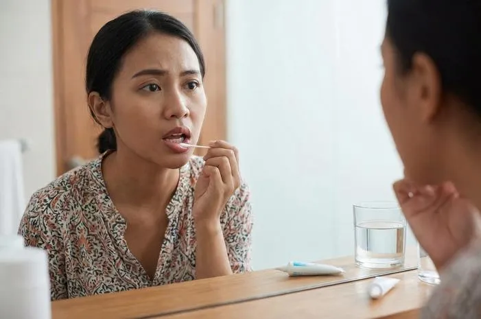 Sariawan Berdarah? Tenang, Ini 5 Cara Jitu Obatinya