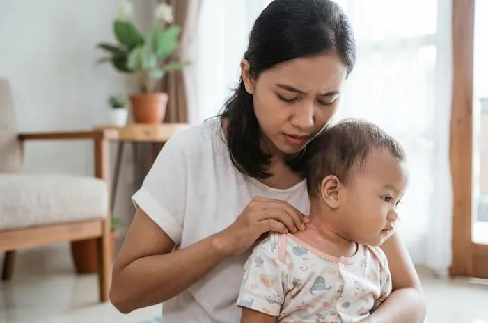 Leher Bayi Merah: Penyebab, Cara Mengatasi, Kapan ke Dokter