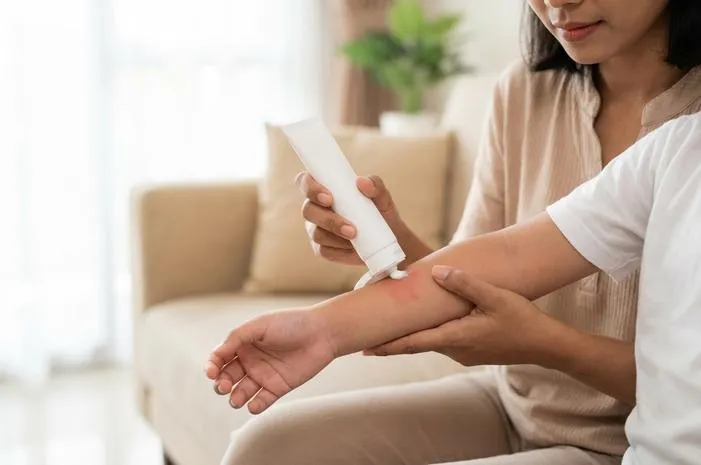 **Rash Cream: Cepat Atasi Ruam, Kulit Bayi Mulus Lagi**