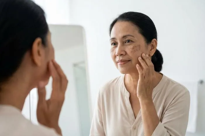 Apakah Flek Hitam Bisa Hilang? Ya, Ini Caranya!