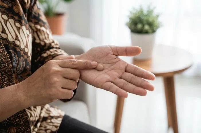 Benjolan di Telapak Tangan: Penyebab dan Cara Mengatasi