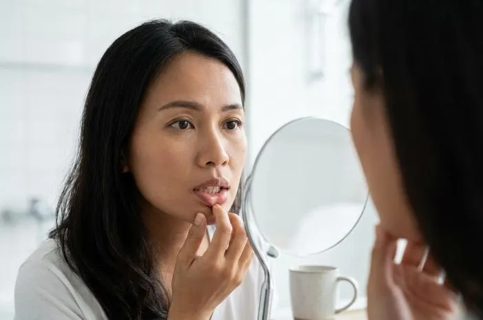 Benjolan Putih di Gusi: Penyebab dan Cara Mengatasinya