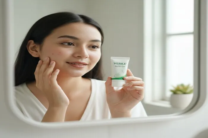 Verile Acne Gel Review: Ampuhkah Atasi Jerawat?