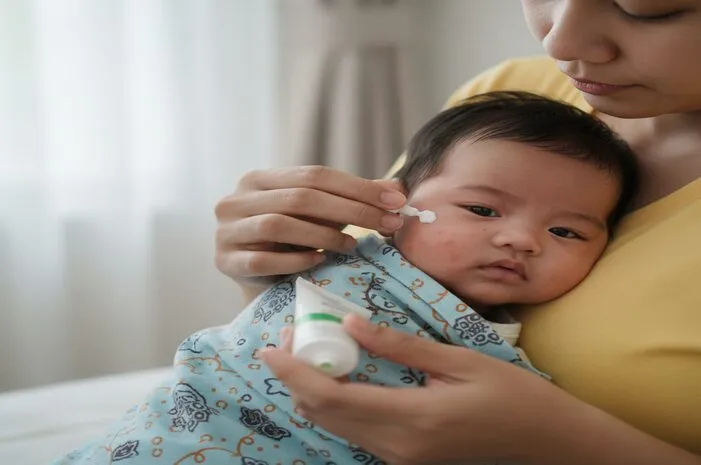 Obat Bruntusan Bayi: Cara Ampuh Atasi dan Tips Jitu