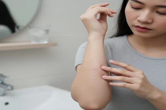 Ciri Alergi Dingin Pada Kulit? Kenali Gejala Utamanya!