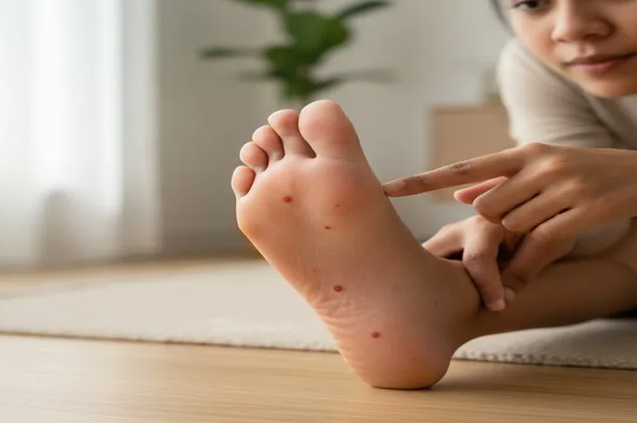 Bintik Merah di Telapak Kaki: Penyebab dan Cara Atasi