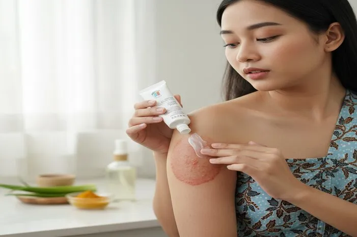 Obati Kurap Lebar: Cara Ampuh & Cepat Sembuh!