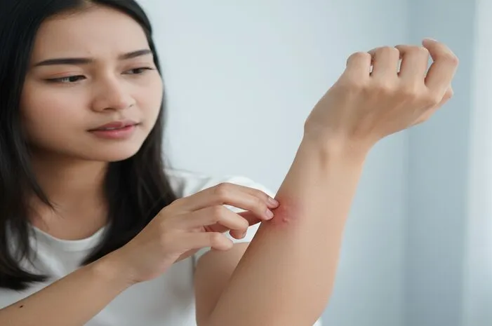 Atasi Kulit Melepuh dan Gatal: Kenali Penyebabnya Sekarang
