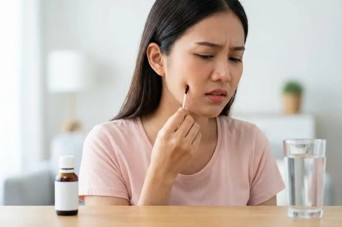 Albothyl Obat Sariawan: Kenapa Tidak Disarankan Lagi?