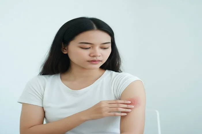 Cara Ampuh Mengatasi Panu Merah Biar Cepat Hilang