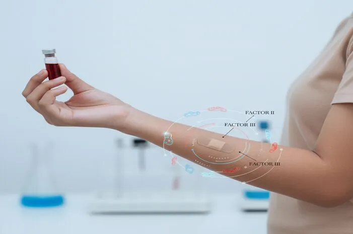 Yuk Kenali Faktor Pembekuan Darah Biar Luka Cepat Sembuh